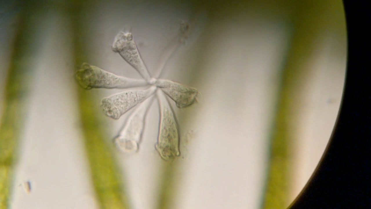 Rotifer in a drop of Pond Water - possibly Conochilas unicornis feeding ...