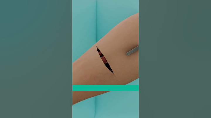 Growing an Ear in your Arm #shorts #3danimation