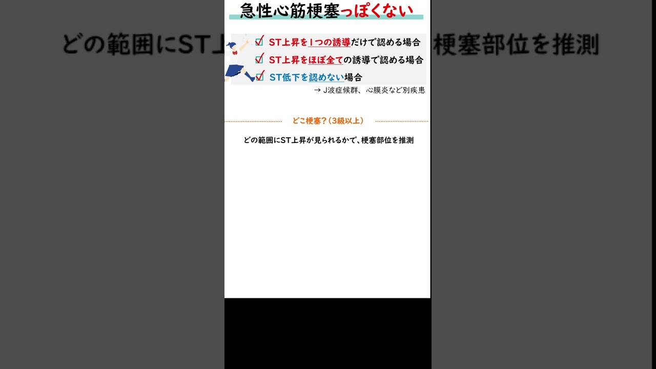 1分間心電図『急性心筋梗塞』　チャレンジ心電図検定4級3級