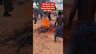 A Benin Man Was Burnt And Buried But Appeared Alive. Power!!!!!!!!!!