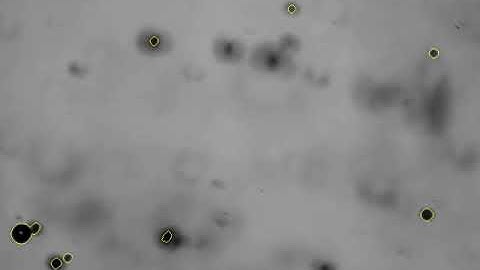 MATLAB Bubble Detection - Sample Video 3