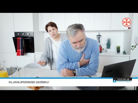 რა არის მოციმციმე არითმია?