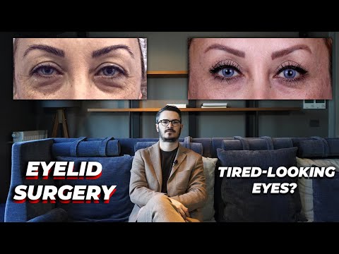 Eyelid surgery, explained