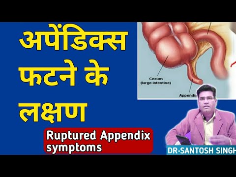 How To Identify Ruptured Appendix Symptoms In Hindi