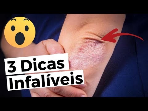 Vídeo: Cotovelos Secos: Remédios, Causas E Muito Mais