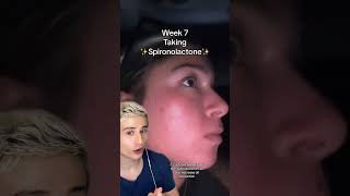 Spironolactone Results #dermreacts #acne #hormonalacne