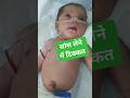 सांस लेने में परेशानी | newborn baby breathing problem #doctors #youtubeshorts #nicu #doctors #lungs