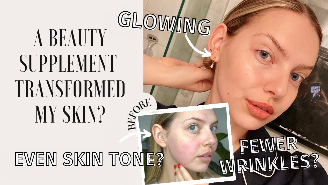 Gallery I Tried A Skin & Gut Beauty Supplement for 20 Days   BEFORE & AFTER Aura  Inner Beauty Radiance is free HD wallpaper.
