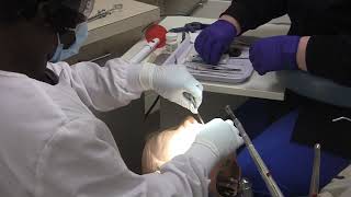 Class III Composite Procedure