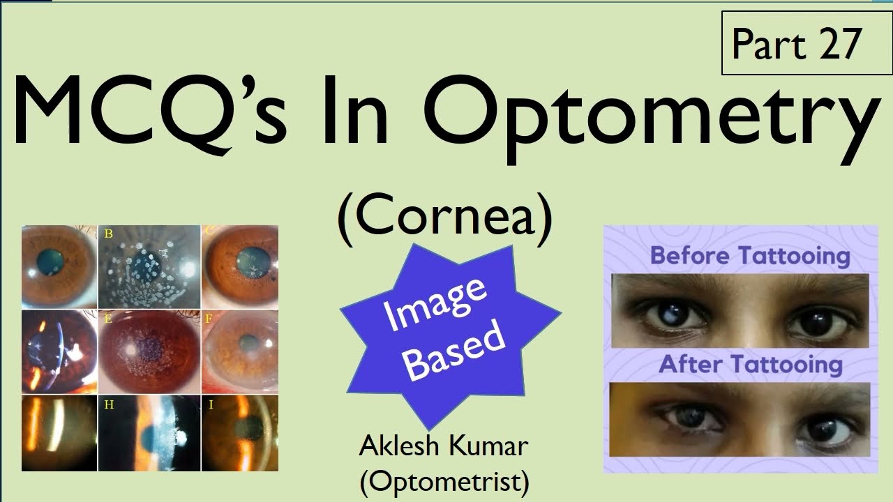 MCQ’s in Optometry | Cornea | Part 27
