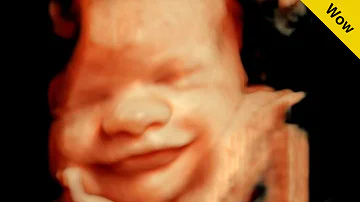 ¿Puede oler un bebé en el útero?