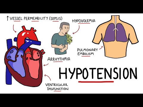 Video: Causes of low blood pressure - primary hypotension, dehydration, drugs, systemic diseases, orthostatic hypotension