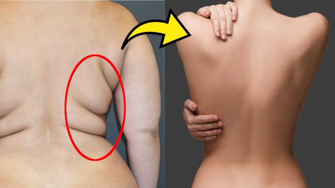 Супер Простой Способ УБРАТЬ БОКА