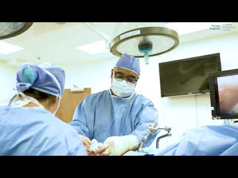 Real Surgery |  Lap Gastric Sleeve Revision | Dr. Nunn | IBI Healthcare Institute