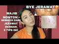 YANG PUNYA JERAWAT WAJIB NONTON ! CARA MENGHILANGKAN JERAWAT DAN BEKAS JERAWAT DENGAN CEPAT PART 2!