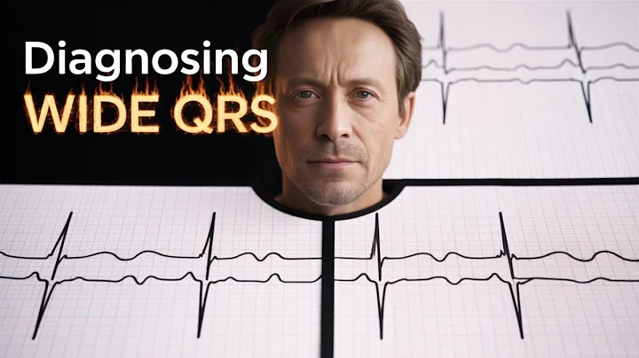 Wide QRS tachy - differential diagnosis & management #wideqrstachycardia #widecomplextachycardia ECG