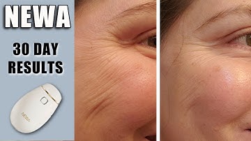 NEWA RADIO FREQUENCY | 30 DAYS UPDATE WITH BEFORE AND AFTERS