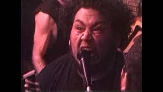 GIRTH VS. RADIATION VOMIT