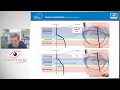 Lentes ocupacionales. ¿Qué, Cómo y Cuándo? - Webinar de Antonio Pérez