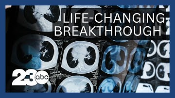 Using AI to detect lung cancer before it develops