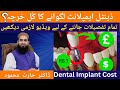 Dental implant cost in pakistan         all you need to know