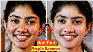 Face Retouching Pimple Remove In Lightroom Easy Trick 2022 | lr face cleaning |lr face pimple remove screenshot 5