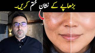 Age Spots Are NOT Normal Aging! | Dr. Zee | डॉक्टर ज़ी
