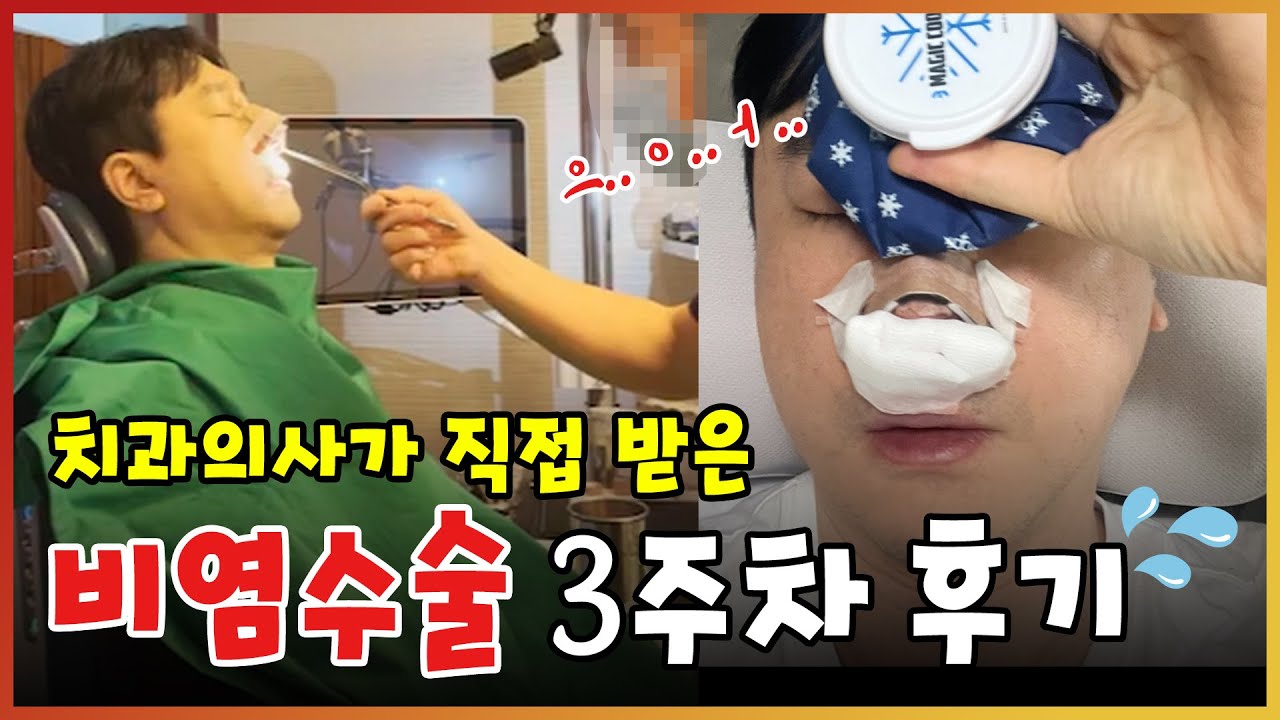 치과의사가 직접 받아본 비염수술 3주차 후기👃 | 비중격만곡증, 하비갑개절제술, 비밸브확장