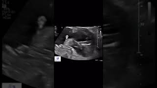 Ultrasound screenshot 4