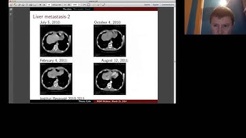 Mathematical Models for Tumor Growth: Construction, Validation and Clinical Applications
