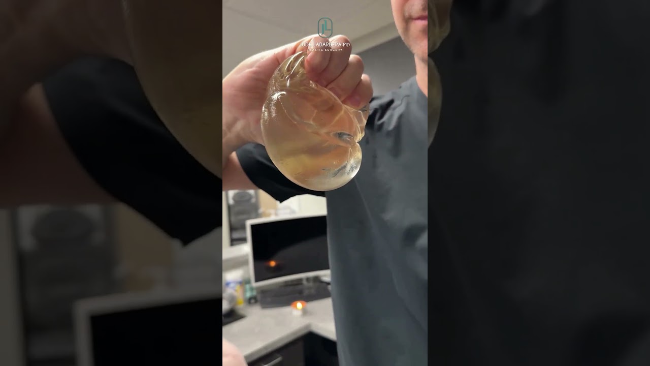 Experience A Transformation Journey Like No Other With Dr. LaBarbera. 