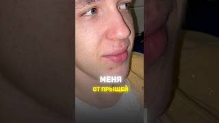 ChatGPT избавил от прыщей Пиши прыщи в нельзяграм danielfadeev скину список прыщи chatgpt