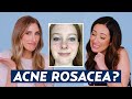 Can You Have Acne AND Rosacea? Dermatologist Reacts to Dana's Skincare Routine | DERM REACTS