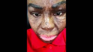 Skin deep