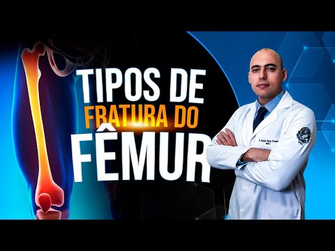 Vídeo: 3 maneiras de quebrar o joelho