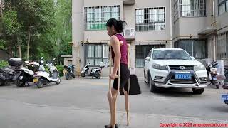 Ayla: Sak Amputee Girl - Learning to Use a New Prosthetic Limb #disability #prosthetics Ayla: Sak Amputee Girl - Learning to Use a New Prosthetic Limb #disability #prosthetics