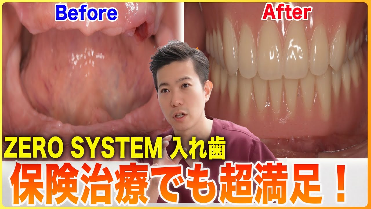 サザエの入れ歯 The Secret to Suction Dentures! Achieve a Secure, Comfortable Fit