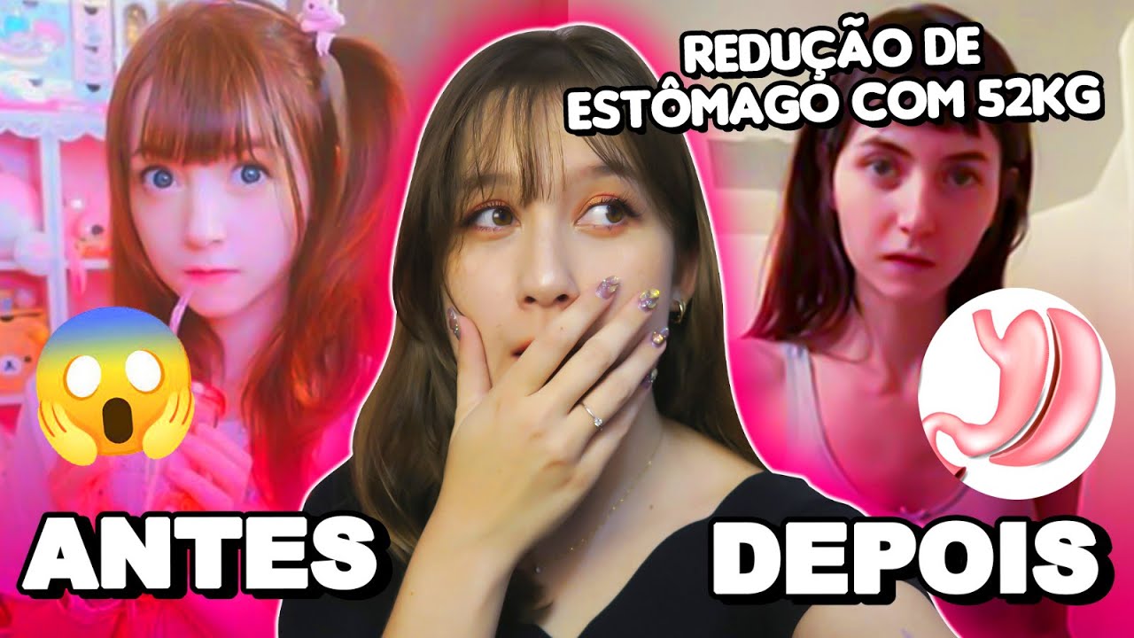 Essa Influencer fez uma CIRURGIA ILEGAL na Coreia 🇰🇷😱 #FofocÁsia