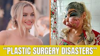 10 Celebrities Before and After Plastic Surgery | Then and Now 2026
