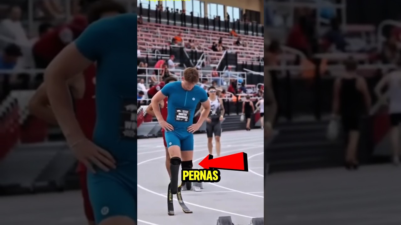 O preconceito Perdeu pra ELE.  💔🔥 