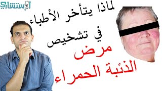 تشخيص الذئبة الحمراء الأعراض والتحاليل ودور الطبيب في التشخيص | الاستشاري