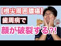 急に顔が破裂するかも？犬猫の根尖周囲膿瘍についてのお話【小動物獣医師のお話 Vol.68】