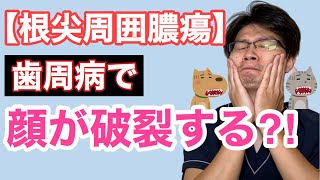 急に顔が破裂するかも？犬猫の根尖周囲膿瘍についてのお話【小動物獣医師のお話 Vol.68】