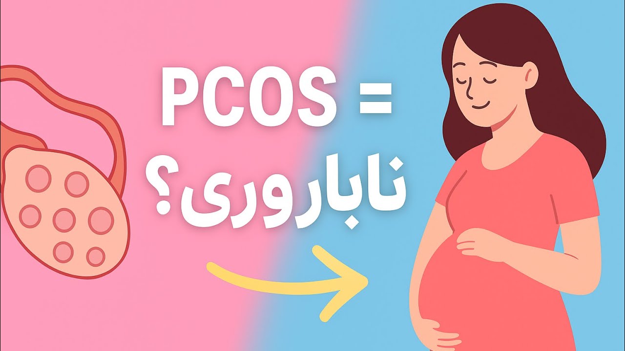 آیا با تخمدان پلی کیستیک(pcos) میتوان باردار شد؟