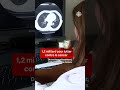 1,2 milliard pour lutter contre le cancer   I Vidéojournal