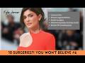 Kylie Jenner Plastic Surgery Costs EXPOSED – Before & After Breakdown! Glow Alert