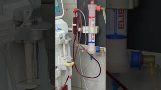 Dialysis process | Detail Video | Dialysis Patient #trendingshorts #2026short