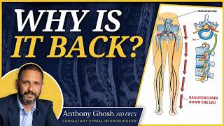 Why Does My Sciatica Keep Coming Back?
