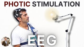 Photic Stimulation on EEG 4 Facts You Need to Know