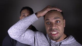 Receding hairline problems @hodgetwins